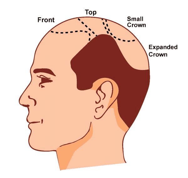 implantation_distribution