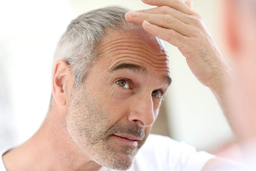 Hair Transplant Diagnosis Totowa, NJ