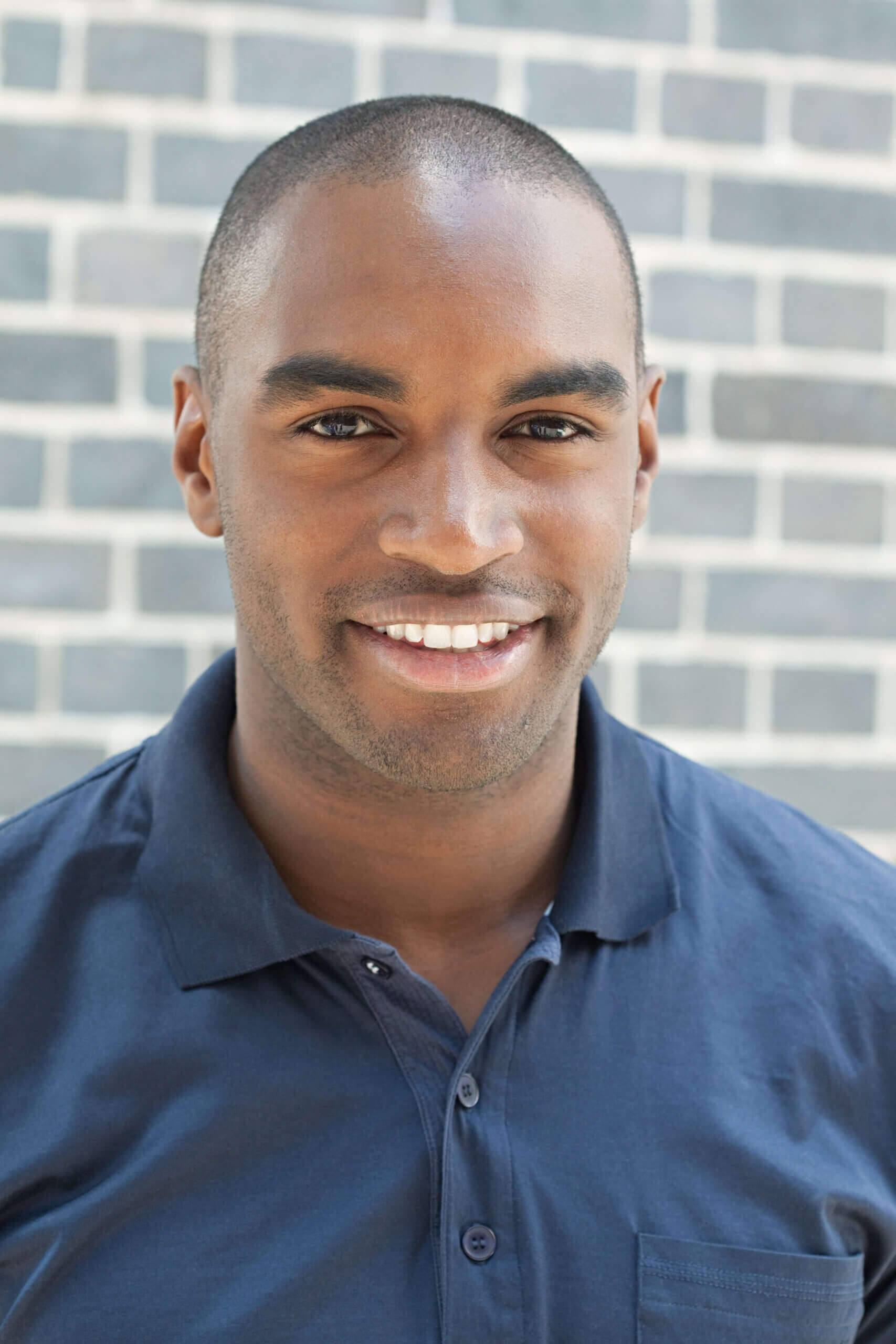 What’s Scalp Micropigmentation?